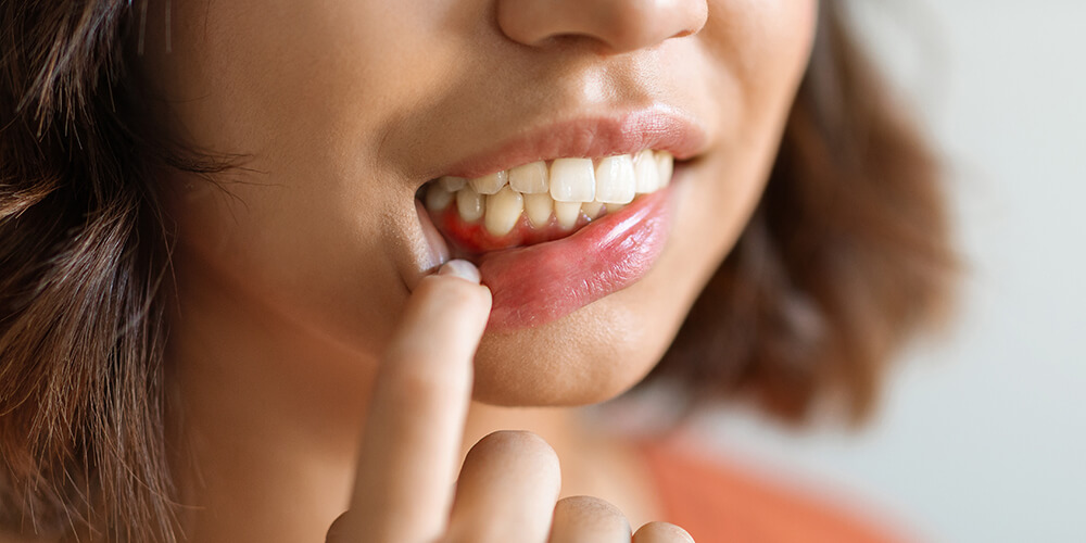 Periodontal Therapy Thamesford